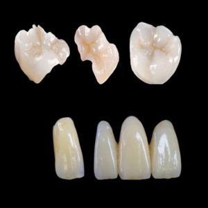 Monolithique disilicate de lithium