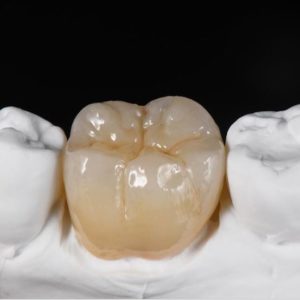 Monolithique zircone